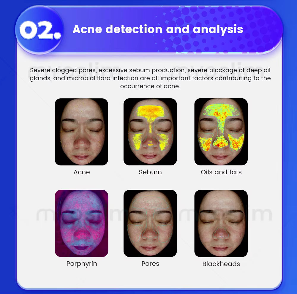 3D Magic Ai Facial Testing Mirror Scanner Skin Detector Skin Analyzer