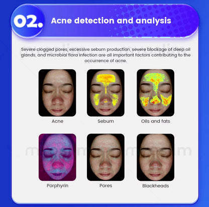 3D Magic Ai Facial Testing Mirror Scanner Skin Detector Skin Analyzer